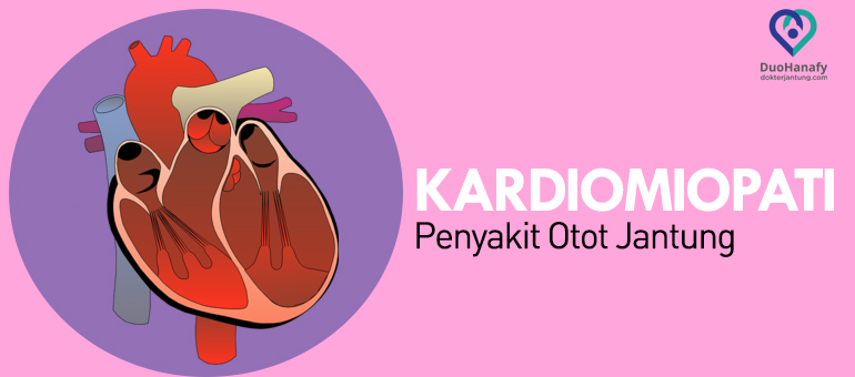 Mengenal Lemah Jantung (Kardiomiopati) dan Faktor Risikonya